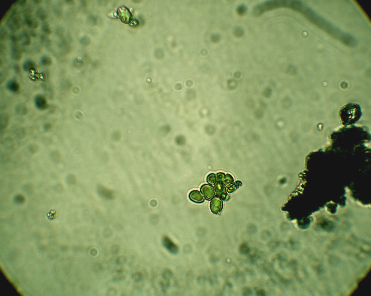 Poltiglia verde: Desmococcus olivaceus